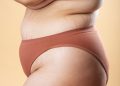 Exploring an Innovative TCM Approach to Address Cellulite