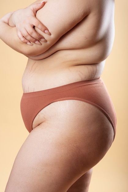 Exploring an Innovative TCM Approach to Address Cellulite